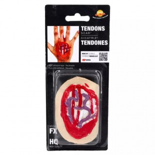  Tendon Hand Scar 10 Cms in Rawda