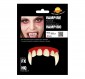 VAMPIRE TEETH WITH THERMOPLASTIC PASTE