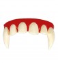 VAMPIRE TEETH WITH THERMOPLASTIC PASTE